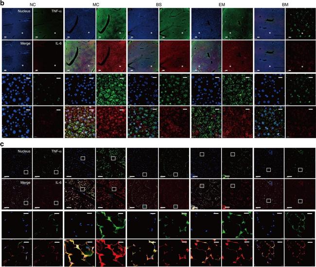 Rabbit IgG (H+L) Cross-Adsorbed Secondary Antibody in Immunohistochemistry (IHC)