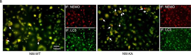 Mouse IgG (H+L) Highly Cross-Adsorbed Secondary Antibody in Immunocytochemistry (ICC/IF)