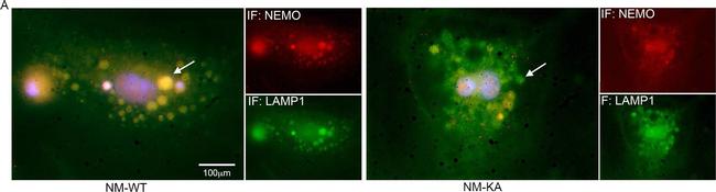 Mouse IgG (H+L) Highly Cross-Adsorbed Secondary Antibody in Immunocytochemistry (ICC/IF)