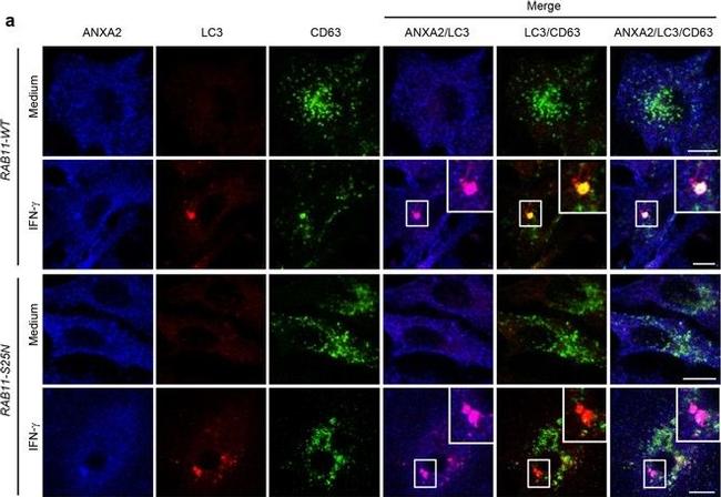 Rabbit IgG (H+L) Highly Cross-Adsorbed Secondary Antibody in Immunocytochemistry (ICC/IF)