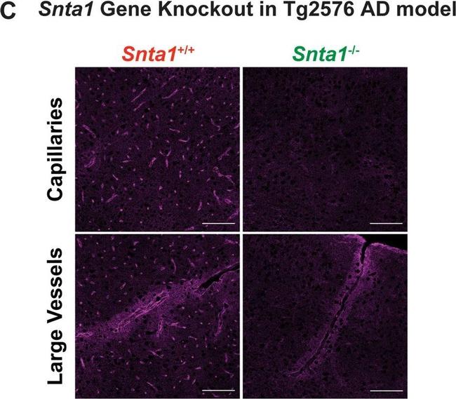 Rabbit IgG (H+L) Highly Cross-Adsorbed Secondary Antibody in Immunohistochemistry (IHC)