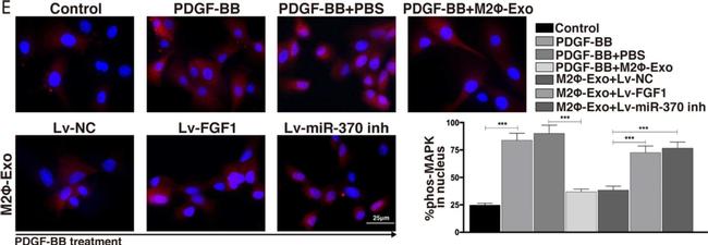 Rabbit IgG (H+L) Highly Cross-Adsorbed Secondary Antibody in Immunocytochemistry (ICC/IF)