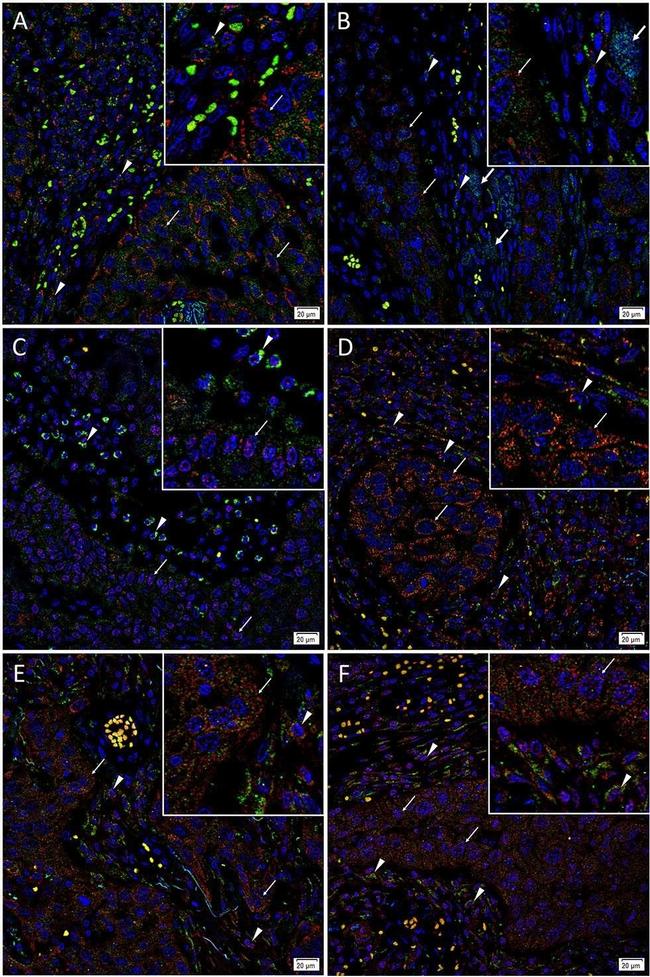 Rabbit IgG (H+L) Highly Cross-Adsorbed Secondary Antibody in Immunohistochemistry (IHC)