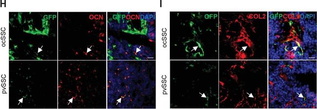 Rabbit IgG (H+L) Highly Cross-Adsorbed Secondary Antibody in Immunocytochemistry (ICC/IF)