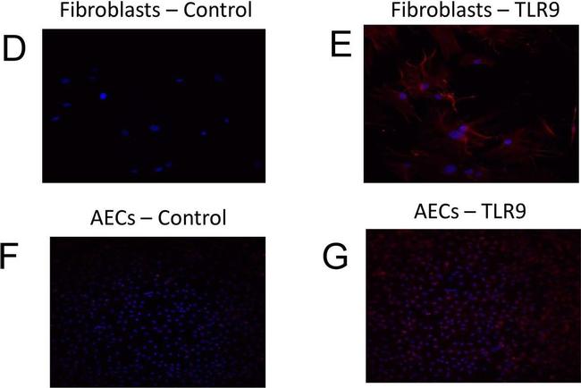 Mouse IgG (H+L) Highly Cross-Adsorbed Secondary Antibody in Immunocytochemistry (ICC/IF)