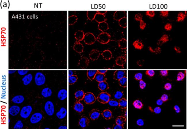 Mouse IgG (H+L) Highly Cross-Adsorbed Secondary Antibody in Immunocytochemistry (ICC/IF)