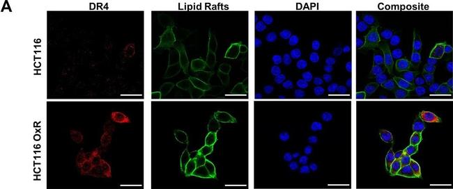 Mouse IgG (H+L) Secondary Antibody in Immunocytochemistry (ICC/IF)