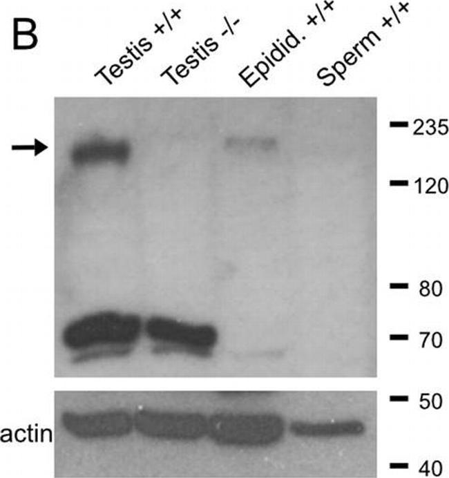 Guinea Pig IgG (H+L) Secondary Antibody in Western Blot (WB)