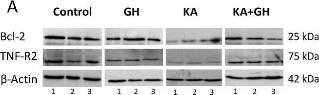 Goat IgG (H+L) Secondary Antibody in Western Blot (WB)