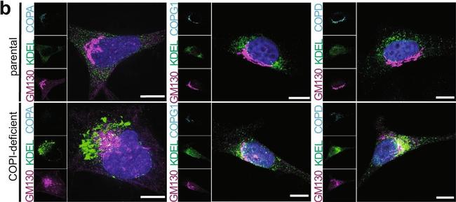 Rabbit IgG (H+L) Highly Cross-Adsorbed Secondary Antibody in Immunocytochemistry (ICC/IF)