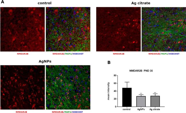 Rabbit IgG (H+L) Cross-Adsorbed Secondary Antibody in Immunohistochemistry (IHC)