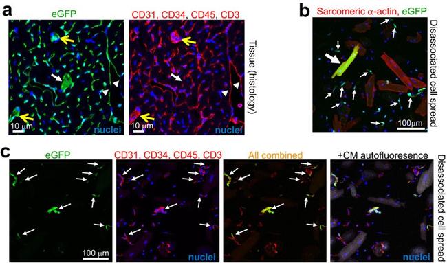 CD34 Antibody in Immunohistochemistry (IHC)