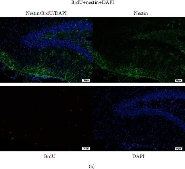 Sheep IgG (H+L) Cross-Adsorbed Secondary Antibody in Immunohistochemistry (Paraffin) (IHC (P))