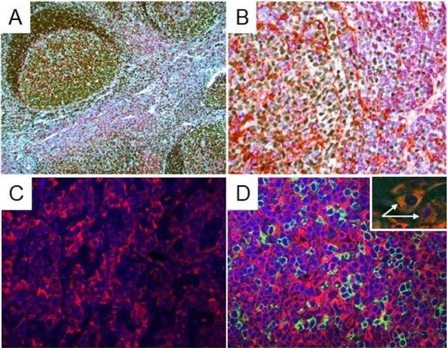 Rabbit IgG (H+L) Highly Cross-Adsorbed Secondary Antibody in Immunohistochemistry (Paraffin) (IHC (P))