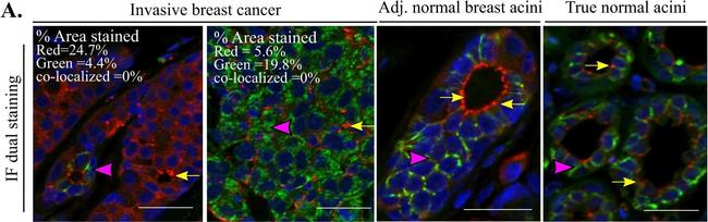 Rabbit IgG (H+L) Highly Cross-Adsorbed Secondary Antibody in Immunohistochemistry (Paraffin) (IHC (P))