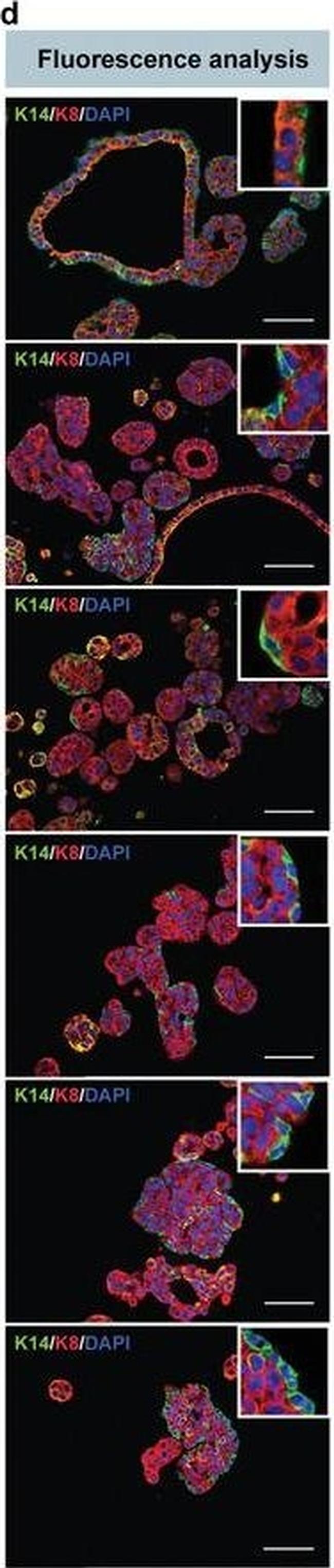 Rabbit IgG (H+L) Highly Cross-Adsorbed Secondary Antibody in Immunohistochemistry (Paraffin) (IHC (P))