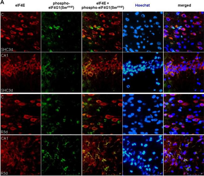 Mouse IgG (H+L) Highly Cross-Adsorbed Secondary Antibody in Immunohistochemistry (IHC)