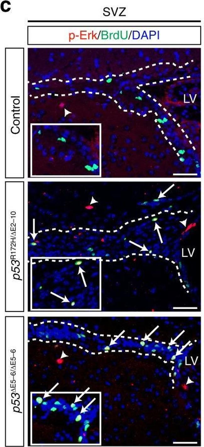 Rabbit IgG (H+L) Highly Cross-Adsorbed Secondary Antibody in Immunohistochemistry (IHC)