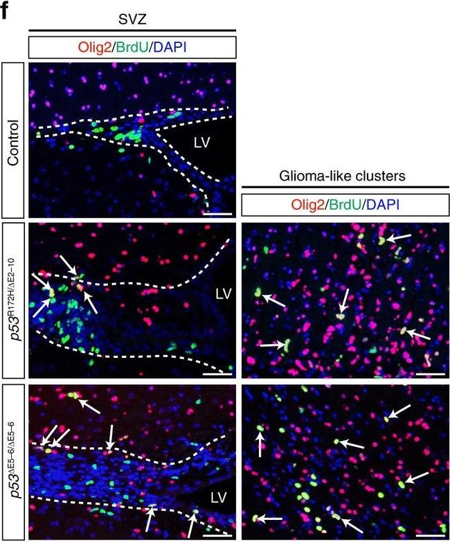 Rabbit IgG (H+L) Highly Cross-Adsorbed Secondary Antibody in Immunohistochemistry (Paraffin) (IHC (P))