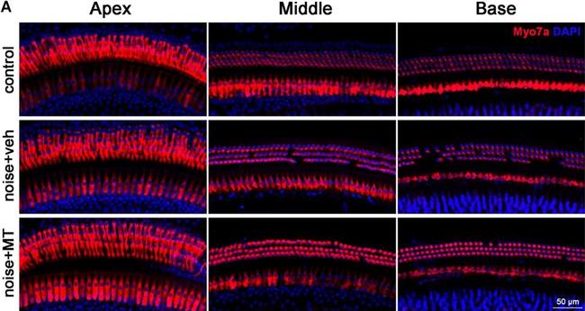 Rabbit IgG (H+L) Highly Cross-Adsorbed Secondary Antibody in Immunohistochemistry (IHC)