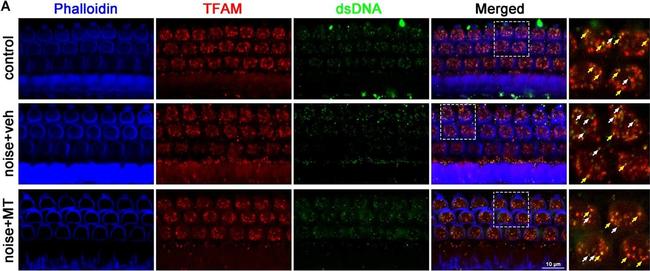 Rabbit IgG (H+L) Highly Cross-Adsorbed Secondary Antibody in Immunohistochemistry (IHC)