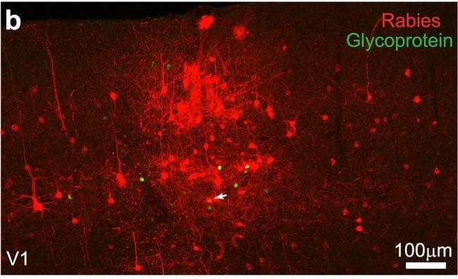 Rabbit IgG (H+L) Highly Cross-Adsorbed Secondary Antibody in Immunohistochemistry (IHC)