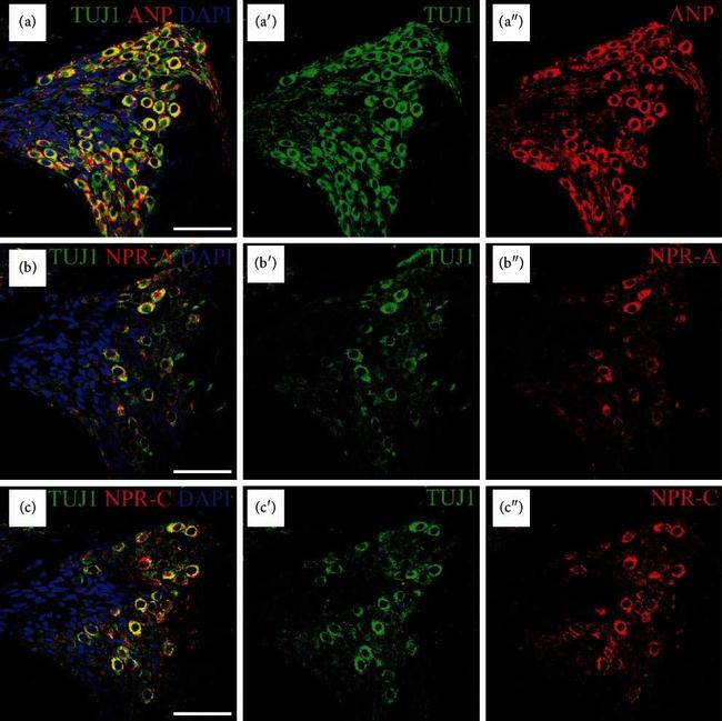 Rabbit IgG (H+L) Highly Cross-Adsorbed Secondary Antibody in Immunohistochemistry (IHC)