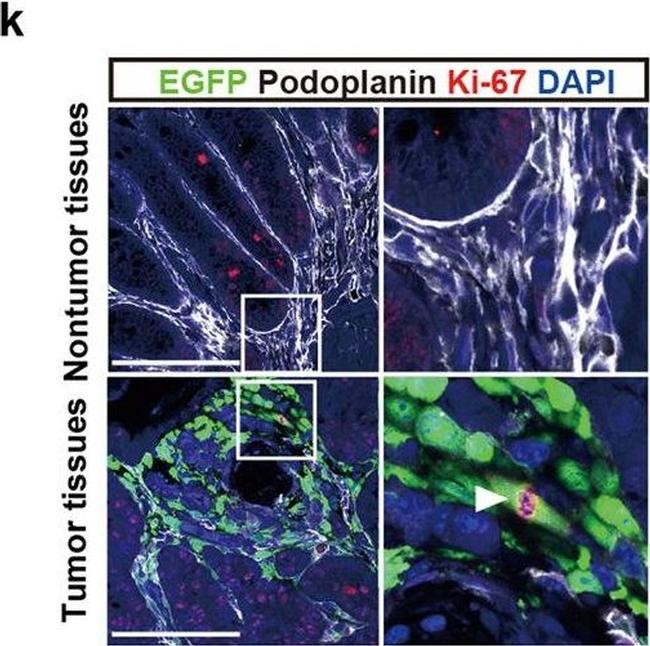 Rabbit IgG (H+L) Highly Cross-Adsorbed Secondary Antibody in Immunohistochemistry (IHC)