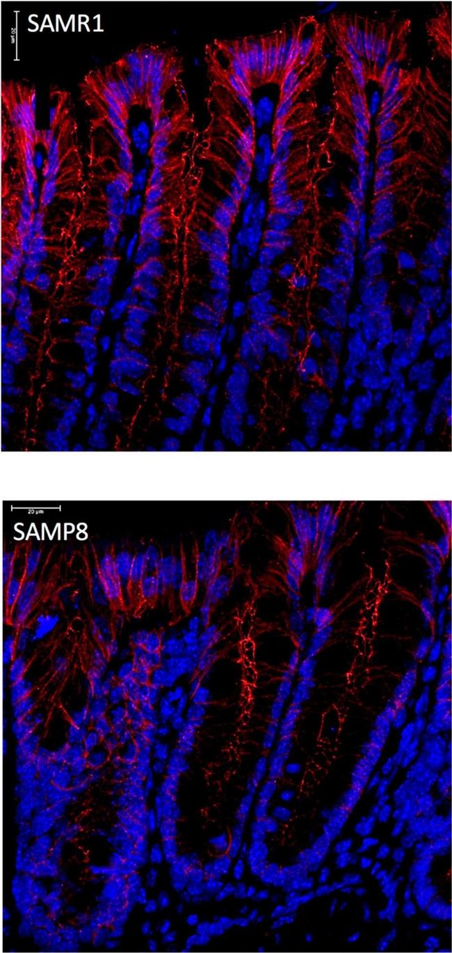 Rabbit IgG (H+L) Highly Cross-Adsorbed Secondary Antibody in Immunocytochemistry (ICC/IF)