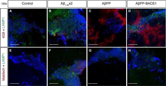 Mouse IgG (H+L) Cross-Adsorbed Secondary Antibody in Immunohistochemistry (PFA fixed) (IHC (PFA))