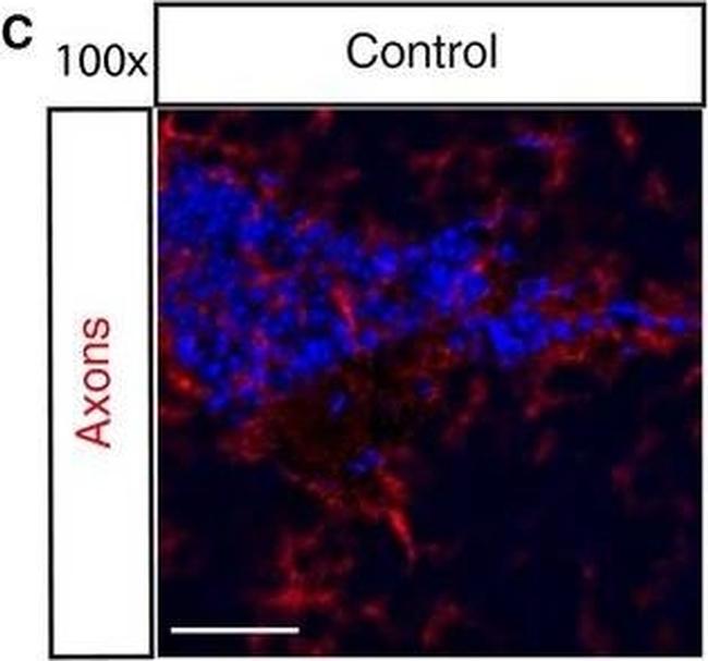 Mouse IgG (H+L) Cross-Adsorbed Secondary Antibody in Immunohistochemistry (PFA fixed) (IHC (PFA))