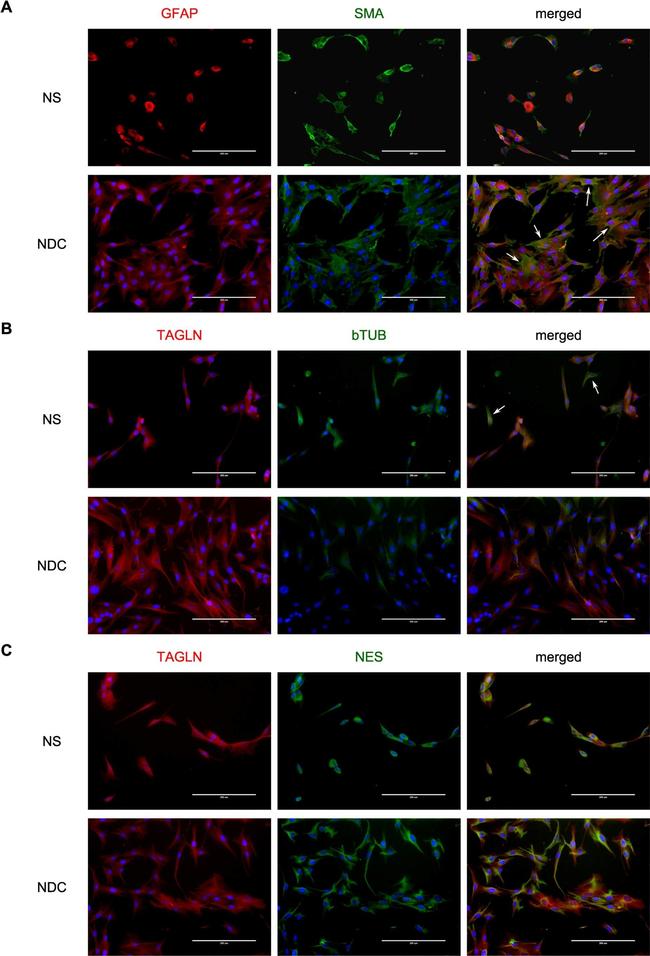 Rabbit IgG (H+L) Cross-Adsorbed Secondary Antibody in Immunocytochemistry (ICC/IF)