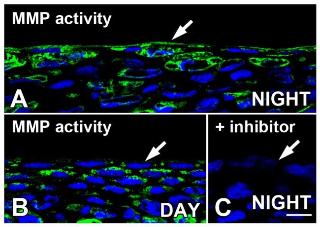 MMP2 Antibody