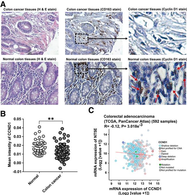 CD163 Antibody in Immunohistochemistry (IHC)