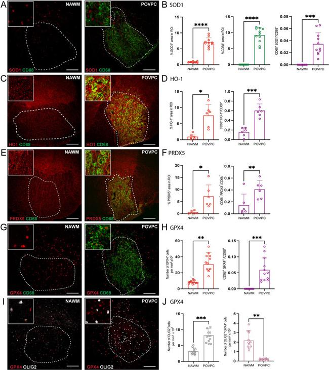 PRDX5 Antibody in Immunohistochemistry (IHC)