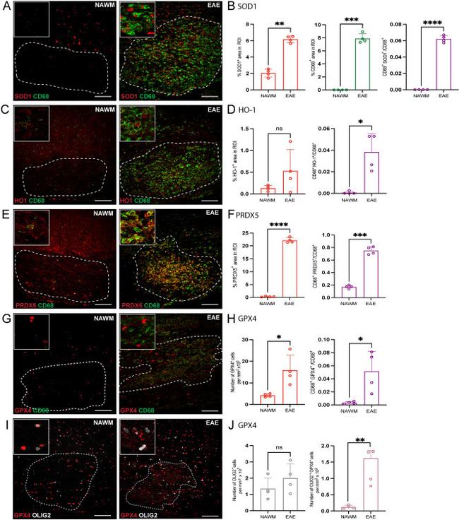 PRDX5 Antibody in Immunohistochemistry (IHC)