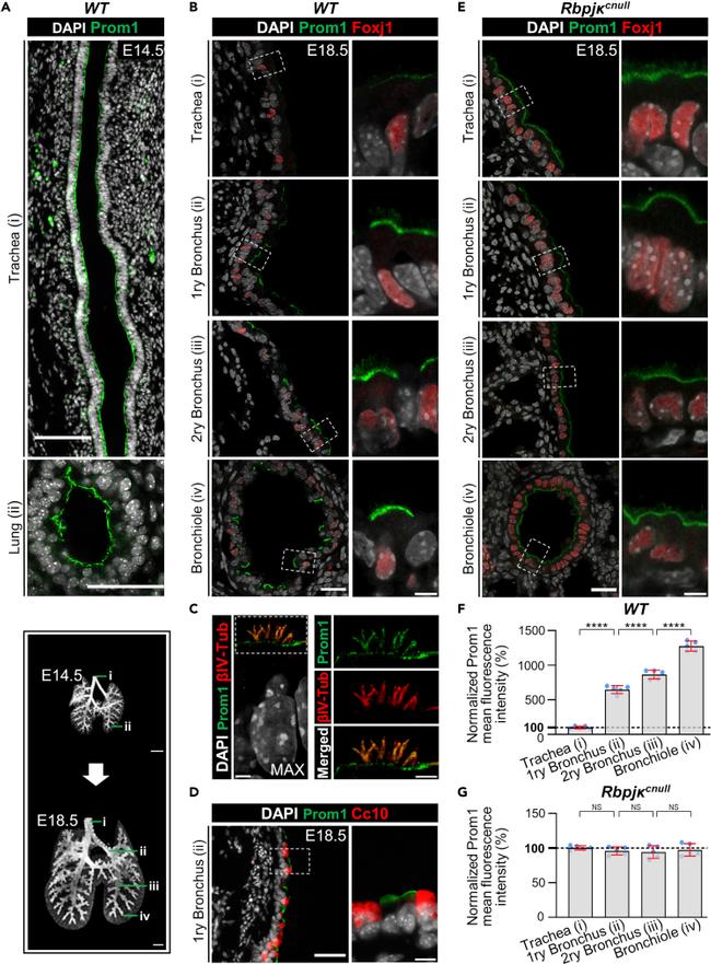 FOXJ1 Antibody in Immunohistochemistry (IHC)