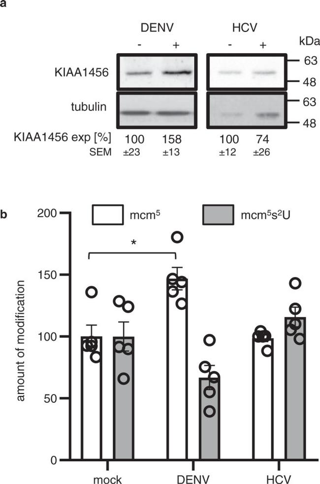 KIAA1456 Antibody in Western Blot (WB)