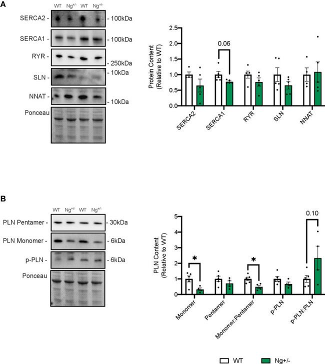 SERCA1 ATPase Antibody in Western Blot (WB)