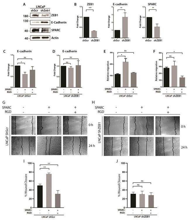 ZEB1 Antibody in Western Blot (WB)