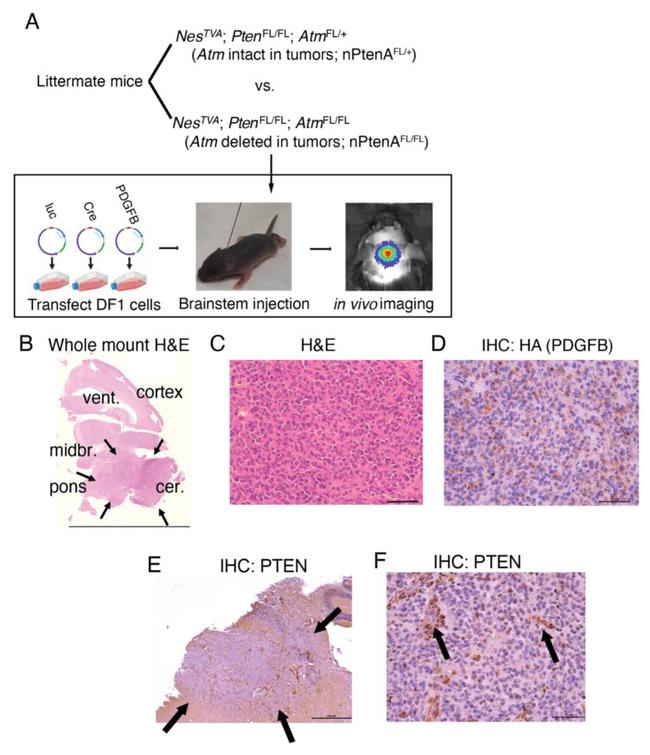 PTEN Antibody in Immunohistochemistry (IHC)