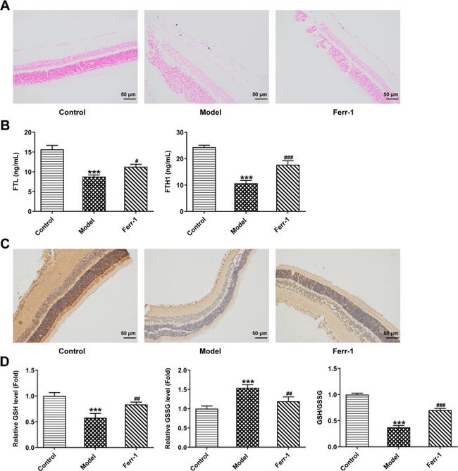 GPX4 Antibody in Immunohistochemistry (IHC)