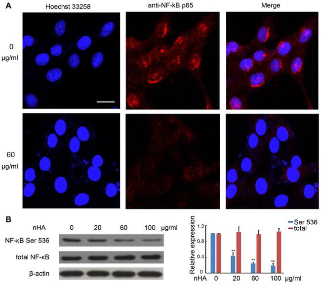 NFkB p65 Antibody in Western Blot, Immunocytochemistry (WB, ICC/IF)