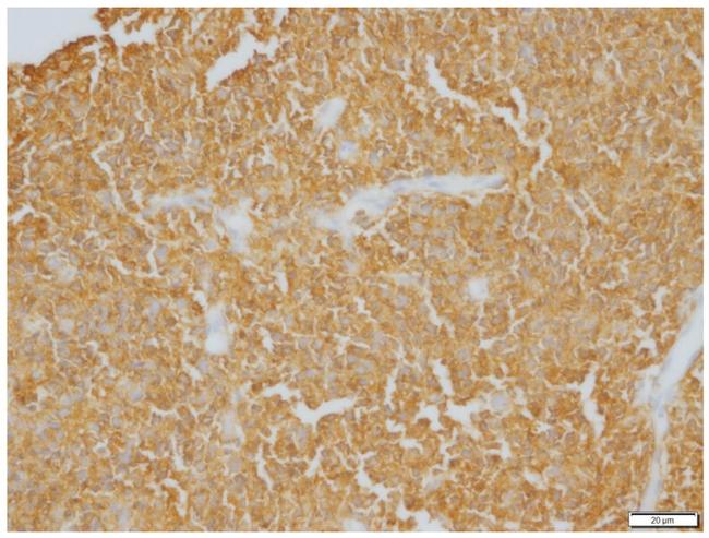 CD20 Polyclonal Antibody (PA5-16701)