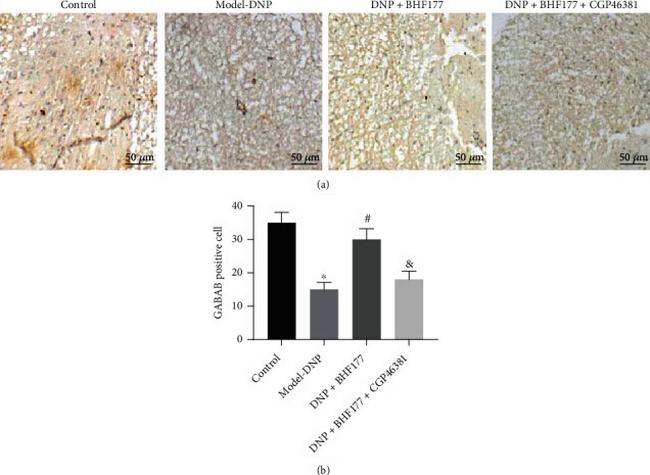 GABBR1 Antibody in Immunohistochemistry (IHC)