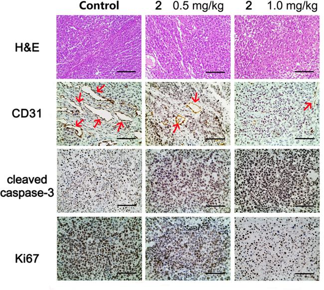 CD31 Antibody in Immunohistochemistry (IHC)