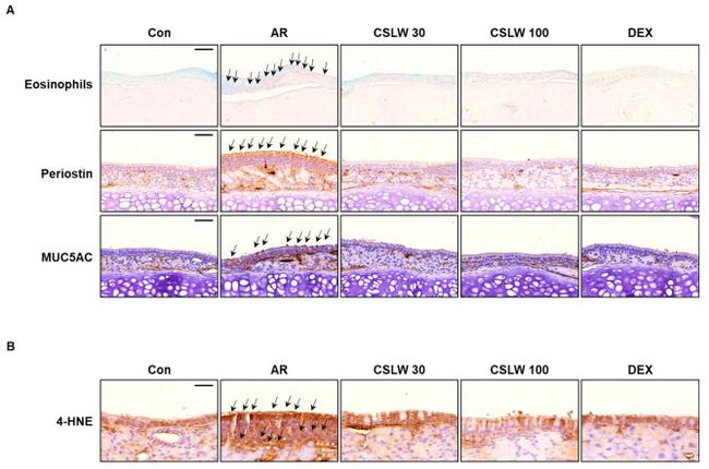 Periostin Antibody in Immunohistochemistry (IHC)