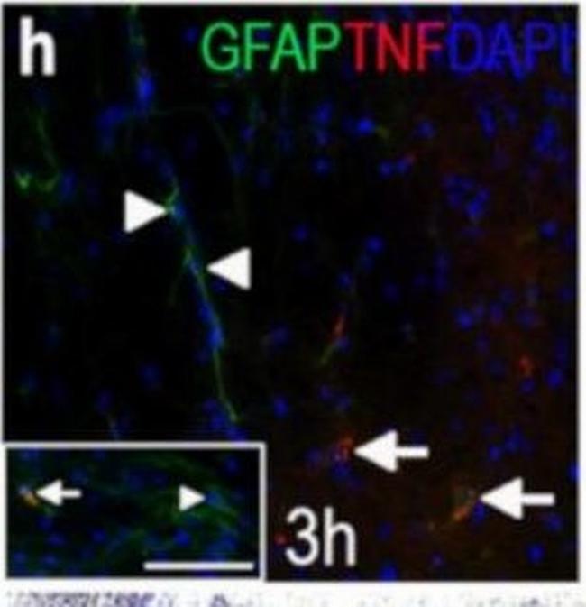 Rabbit IgG (H+L) Highly Cross-Adsorbed Secondary Antibody in Immunohistochemistry (IHC)