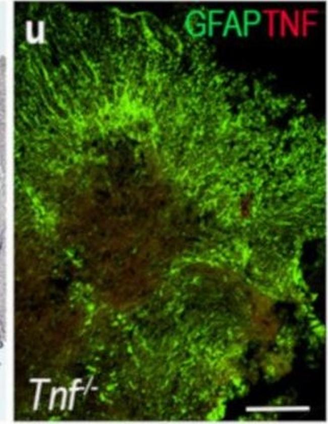 Rabbit IgG (H+L) Highly Cross-Adsorbed Secondary Antibody in Immunohistochemistry (IHC)