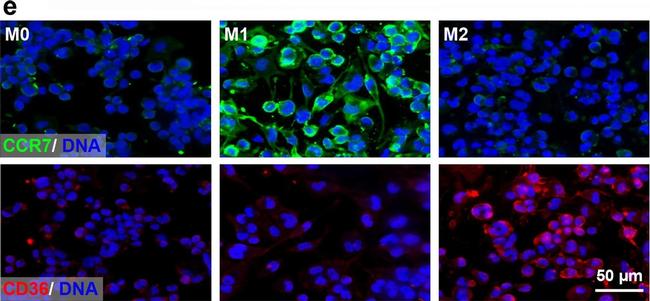 Rabbit IgG (H+L) Cross-Adsorbed Secondary Antibody in Immunocytochemistry (ICC/IF)